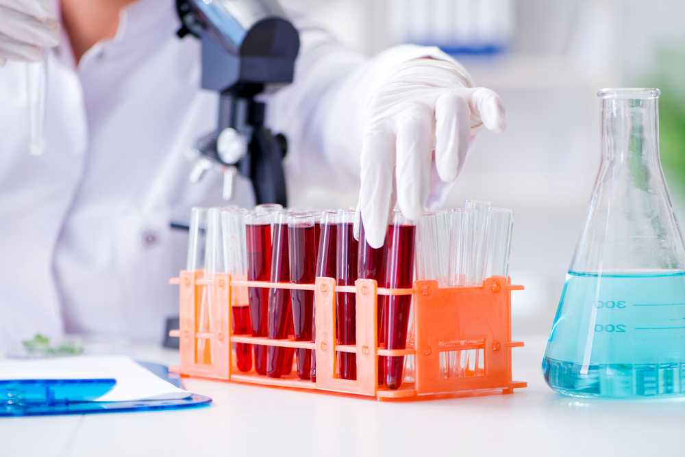 a gloved hand picking up a test tube blood sample