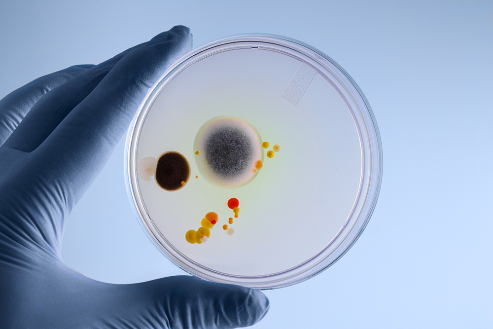 a gloved hand next to a petri dish with bacteria in