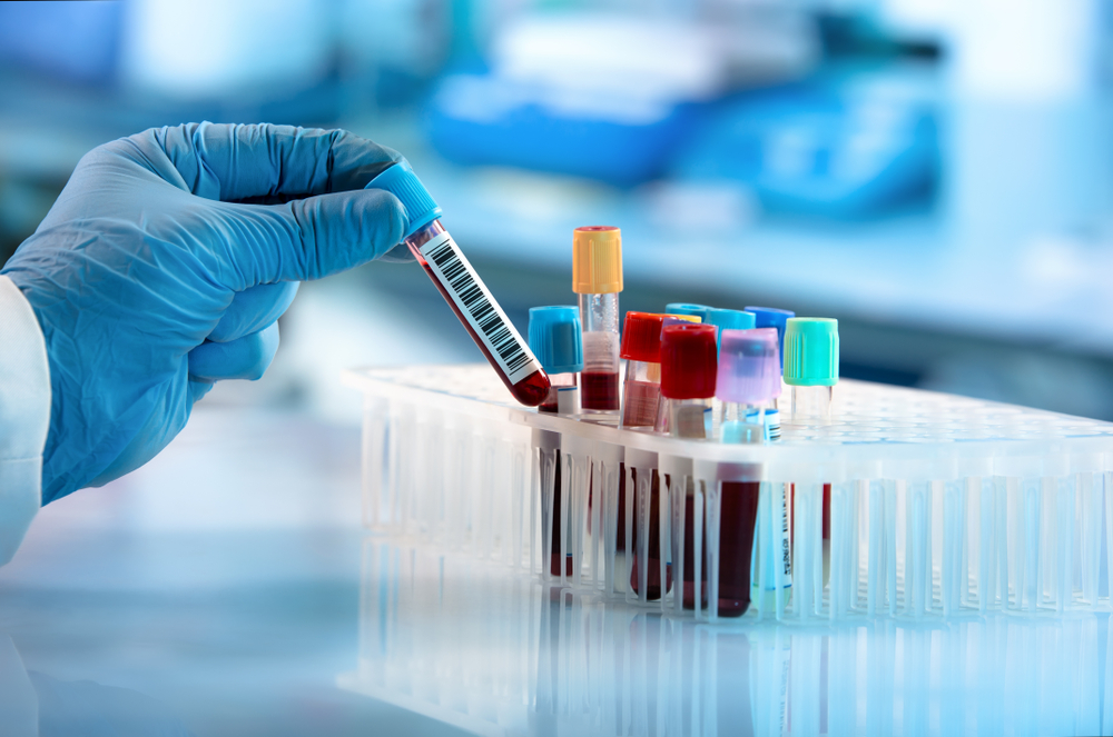 A gloved hand picking up a blood sample.